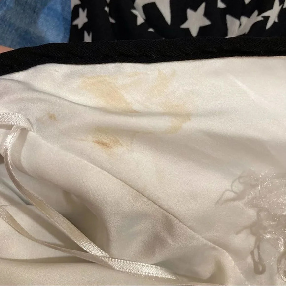 FINDERS KEEPERS Winter Birds Dress Hibiscus Print and Black Size XS - Picture 12 of 15